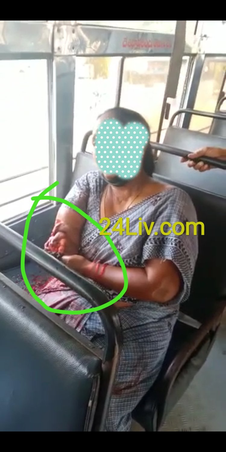 బస్సు ప్రయాణం లో మహిళ చెయ్యి తెగి పోయింది. WOmam Losthand in bus journey in Andhra